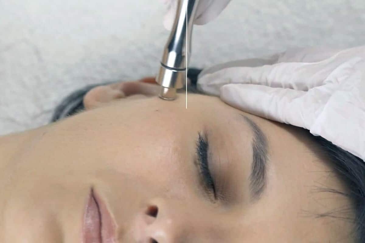Inestetismi cutanei come contrastarli